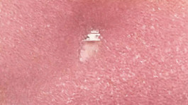 JEAN-BAPTISTE VILLECHAIZE